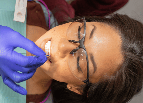 Fluoride varnish applied to adult's teeth