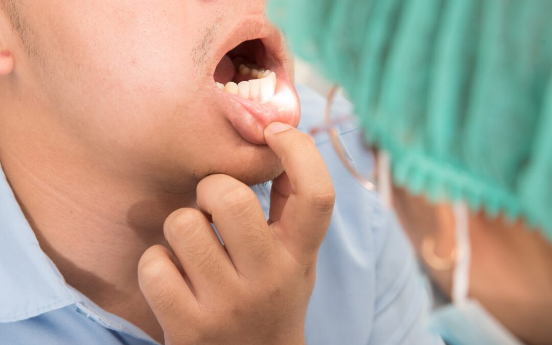 6 Questions on HPV That Every Dental Health Provider Should Know