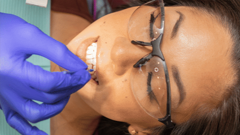 Dental Professional in Purple Gloves Working on a Patient's Teeth While the Patient Wears Safety Goggles and Braces.